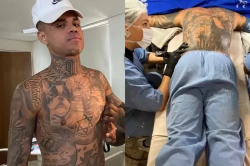 MC Cabelinho toma anestasia geral para fazer tatuagem — Foto: Reprodução/Instagram