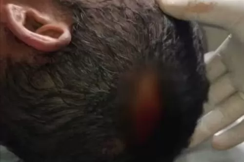 Vítima tinha corte na cabeça — Foto: Polícia Militar