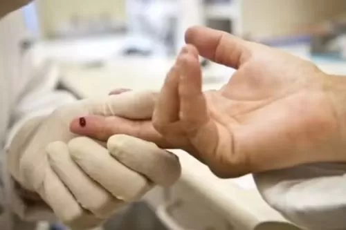 Teste rápido de HIV — Foto: Divulgação